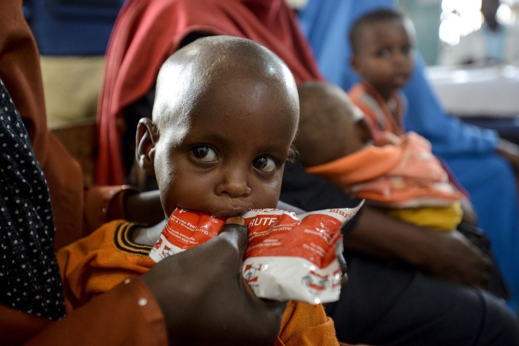 Soomaaliya oo ka mid ah afar dal oo laga digayo nafaqo-darrada carruurta