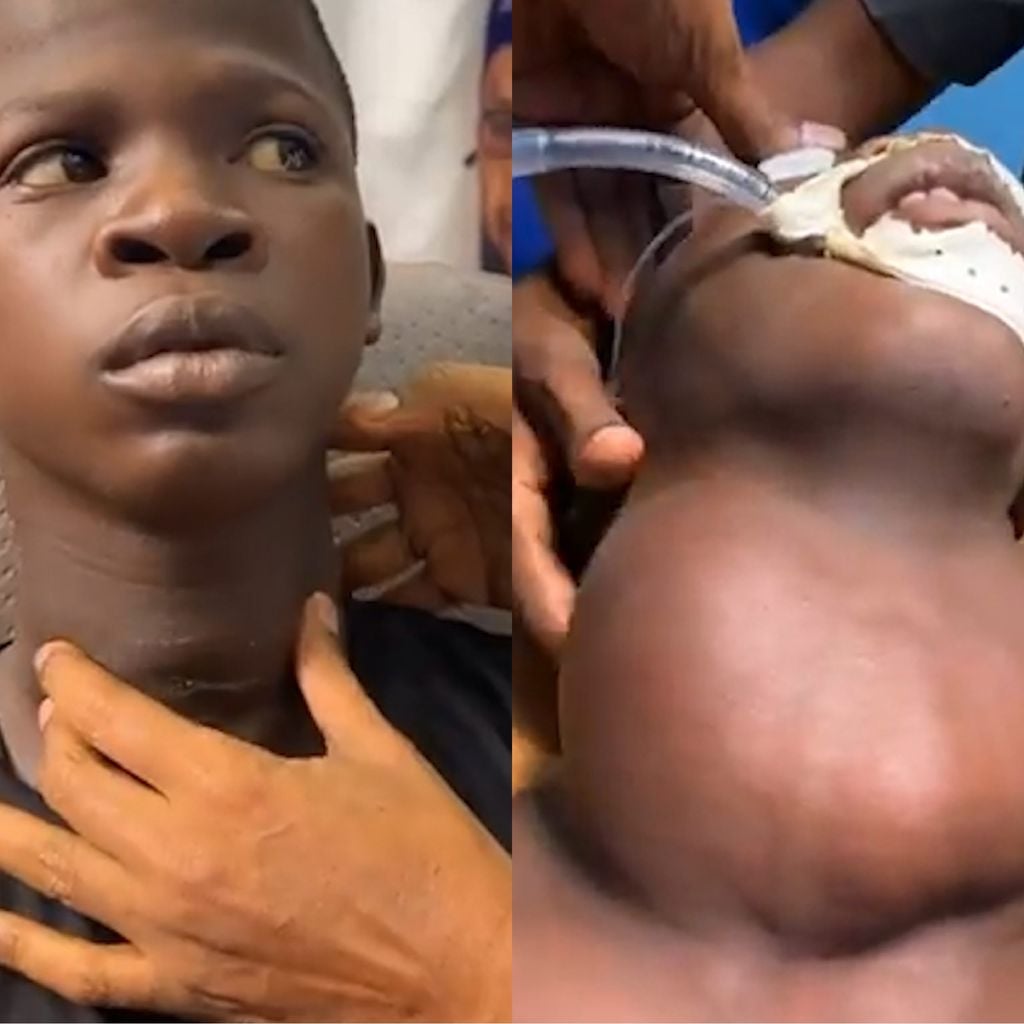 Dhakhtar Soomaaliyeed oo ku guuleystay inuu saaro Buro halis ah